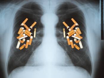 Smoking Cigarettes Cause Lung Damage