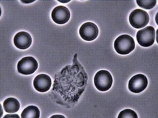 white blood cell Healthy body cells